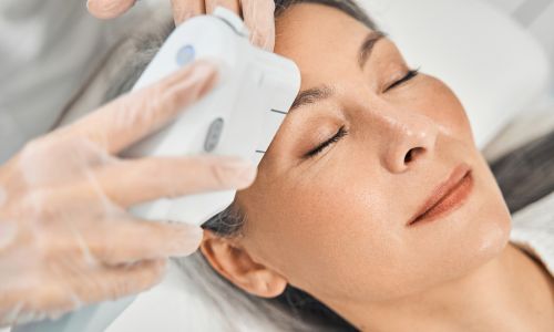 A woman who is nearly 50 years old is undergoing PicoSure laser treatment to tighten her facial skin.